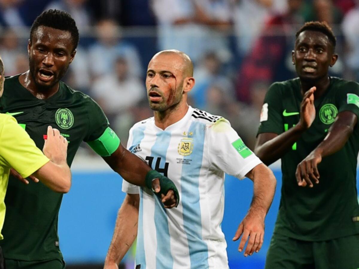 Las heridas de un guerrero: Mascherano terminó con la cara rota