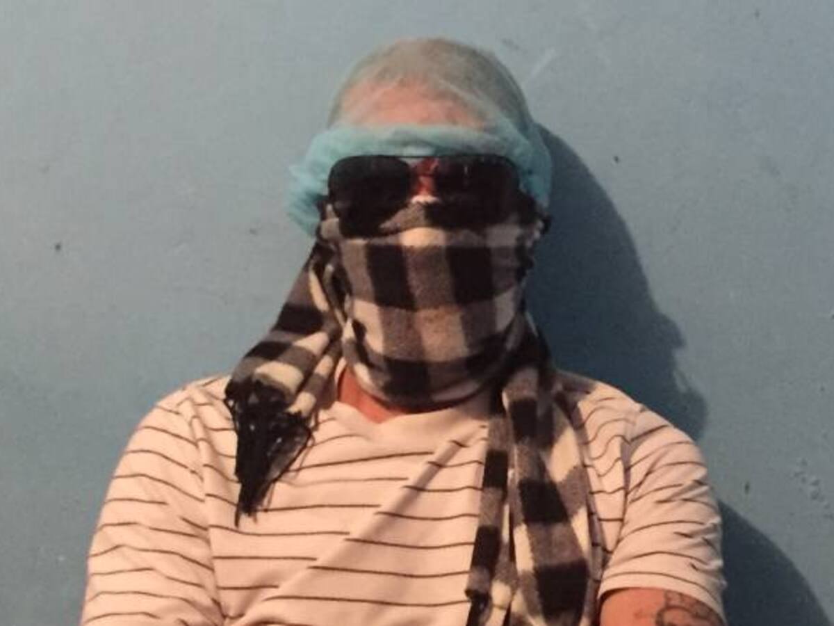 Por una herencia un hombre fue atacado con ácido en Bogotá