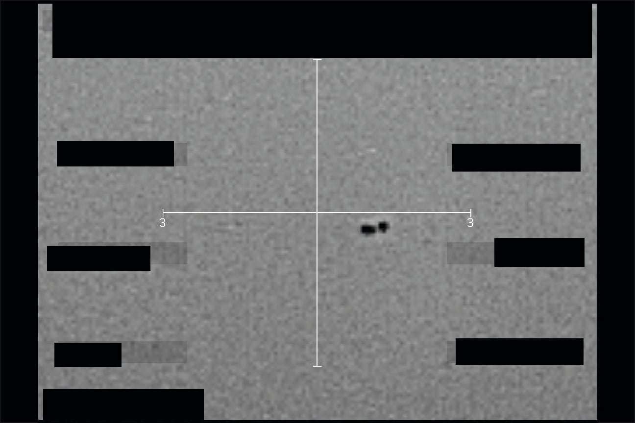 Fotos sobre OVNIS desclasificadas por Estados Unidos. Foto: Departamento de Guerra de Estados Unidos.