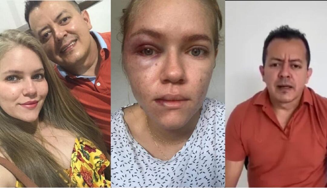 Caso de concejal que golpearía a su esposa