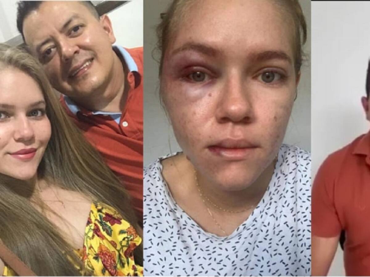 Denuncian retraso en caso de concejal que golpearía a su esposa