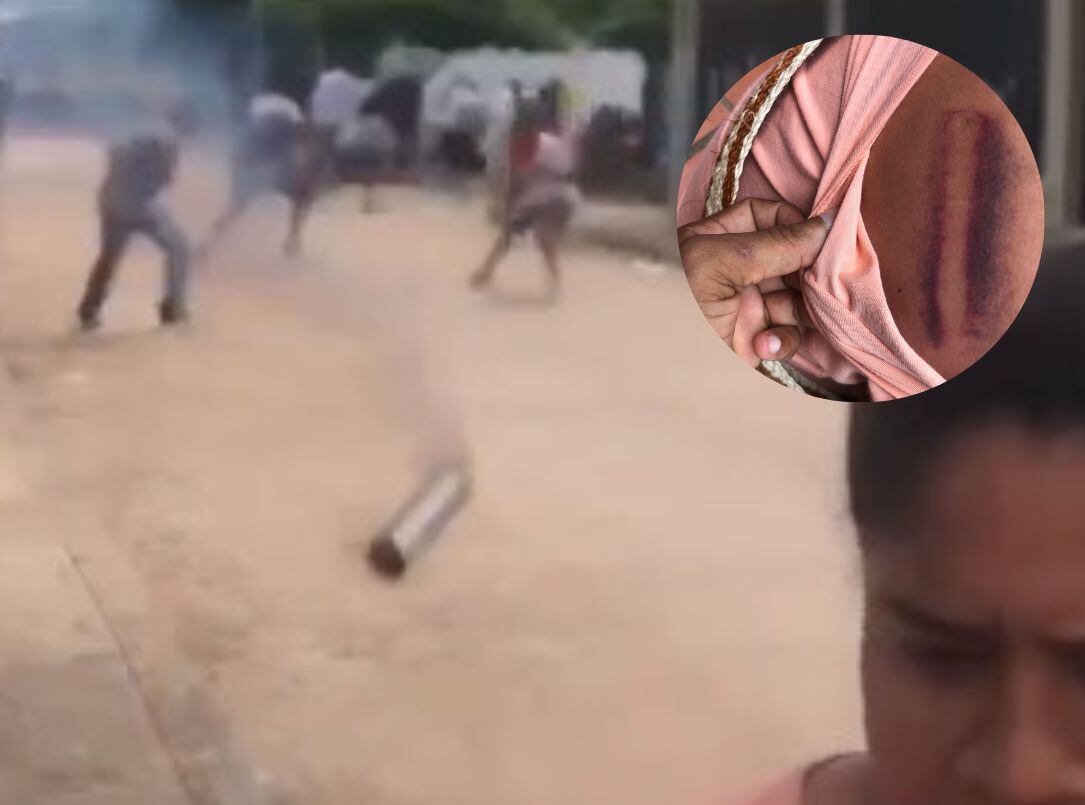 Concejal herida en Becerril./ Foto: Tomada de videos de redes