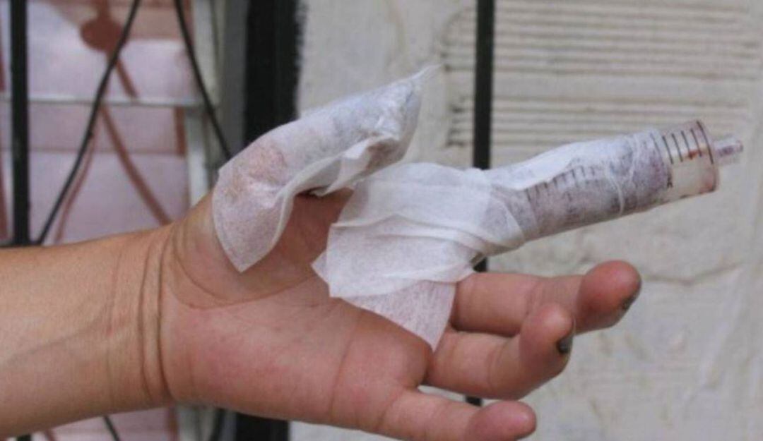 Lesionado con pólvora