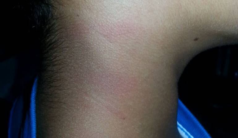 Esta es una de las evidencias de las agresiones contra el menor.