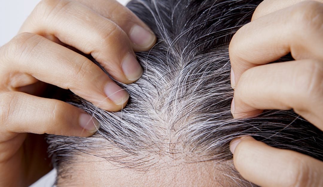 Imagen de referencia sobre alimento para revertir las canas. / Getty Images
