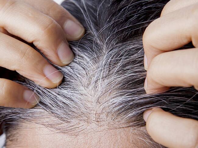 Alimento para revertir las canas: médico experto lo recomienda para combatir el cabello gris