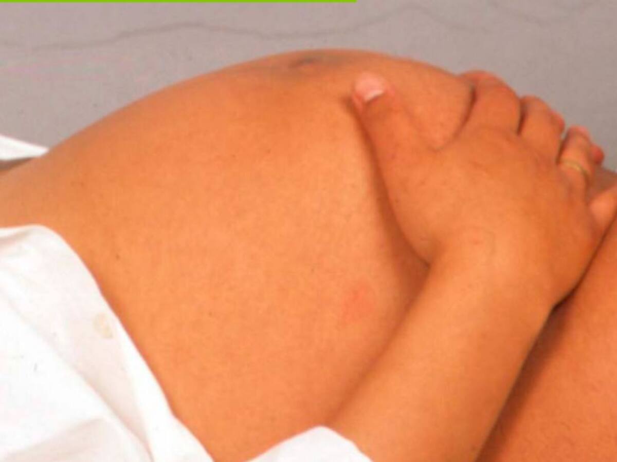 Embarazos adolescentes en Manizales han aumentado en tiempo de pandemia