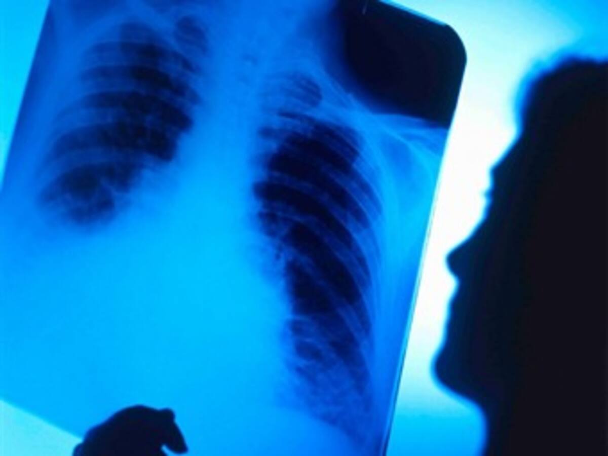 Más de la mitad de los países no están preparados para combatir el cáncer