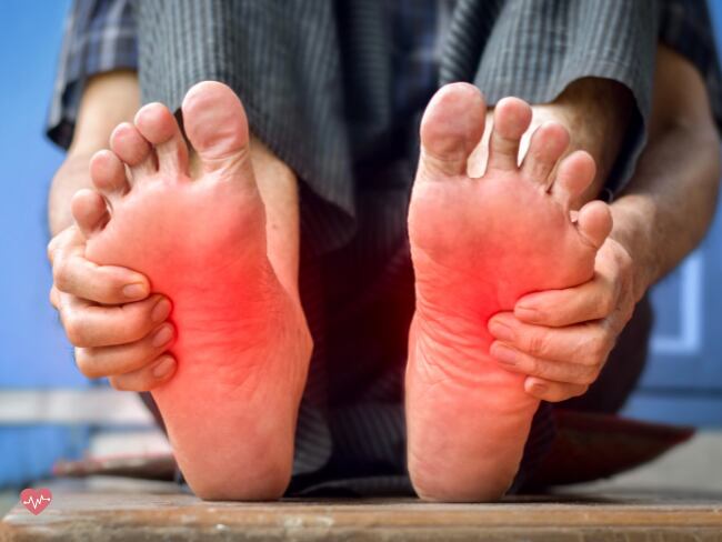 Síndrome de los pies ardientes