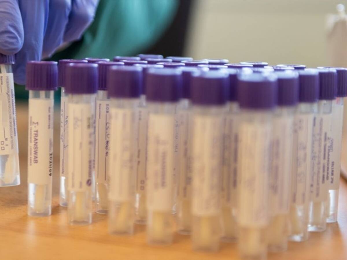 El relato de los médicos en España que están luchando contra el coronavirus