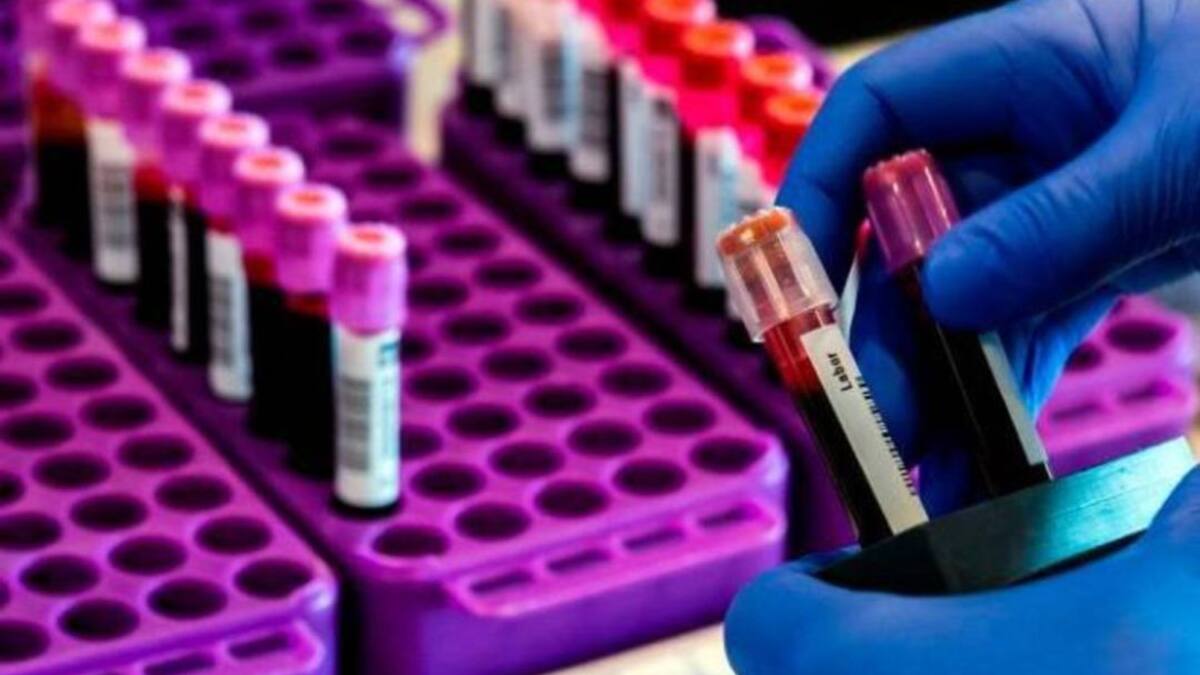 Profesional de salud es el primer caso de COVID-19 en Marsella, Risaralda