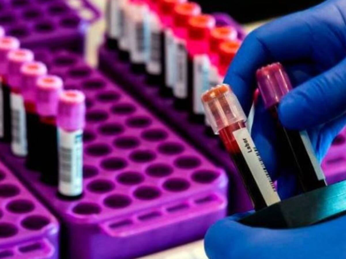 Profesional de salud es el primer caso de COVID-19 en Marsella, Risaralda