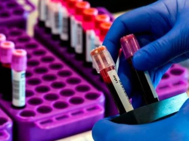 INS aprueba primer laboratorio para diagnóstico de coronavirus en Boyacá