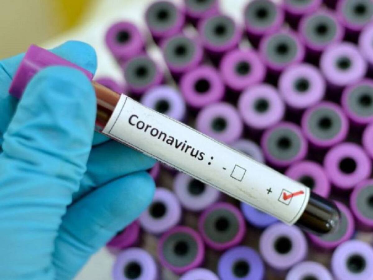 COVID-19 en Cartagena: 145 nuevos casos y 8 muertos