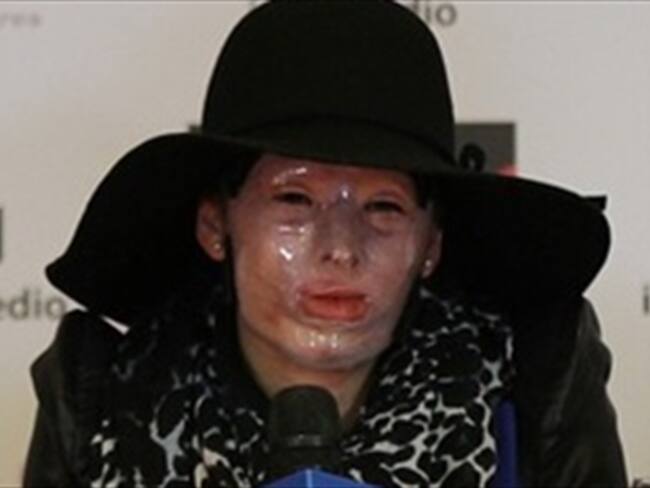 Natalia Ponce pide a Congreso no “hundir” proyecto para agresores con ácido