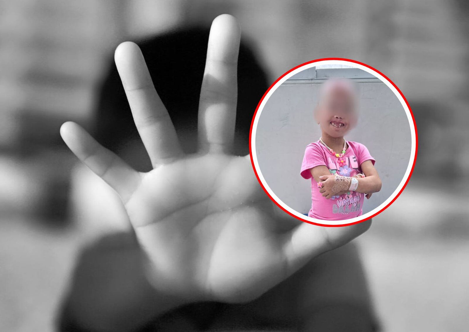 A la menor de 7 años le habrían sacado los dientes con pinzas. Foto: cortesía.