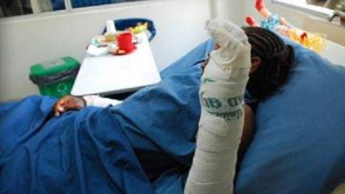 A 27 se eleva el número de lesionados por pólvora en el departamento de Nariño en lo corrido del mes