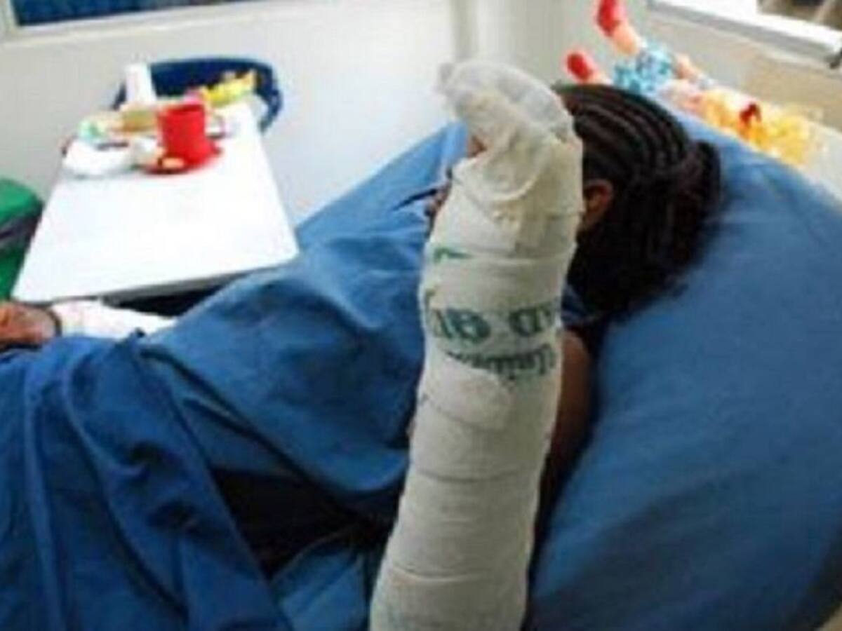 Trece quemados por pólvora en el Valle: Niño de 4 años lesionado en un ojo