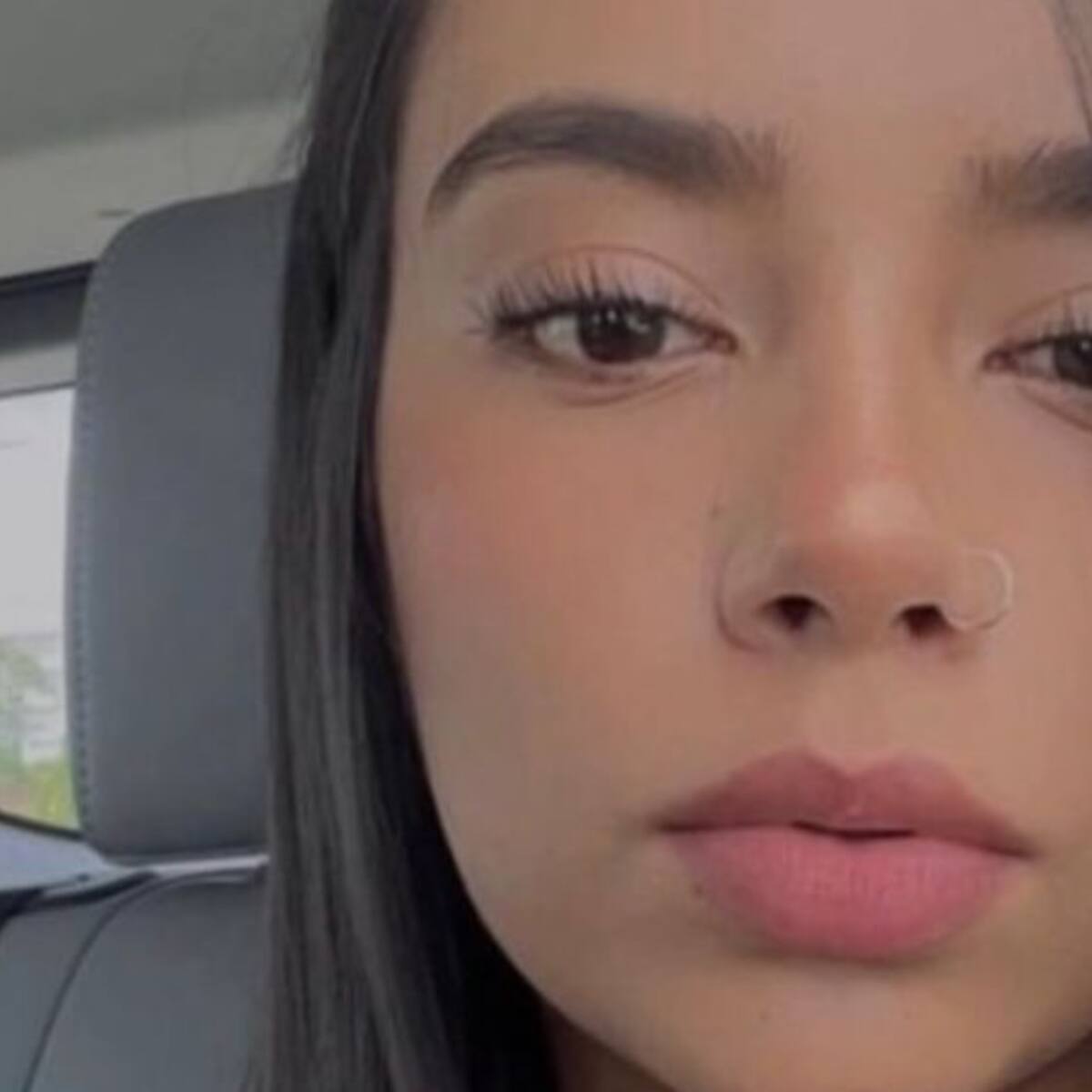 Médicos podrían declarar muerte cerebral a joven colombiana en Miami tras accidente