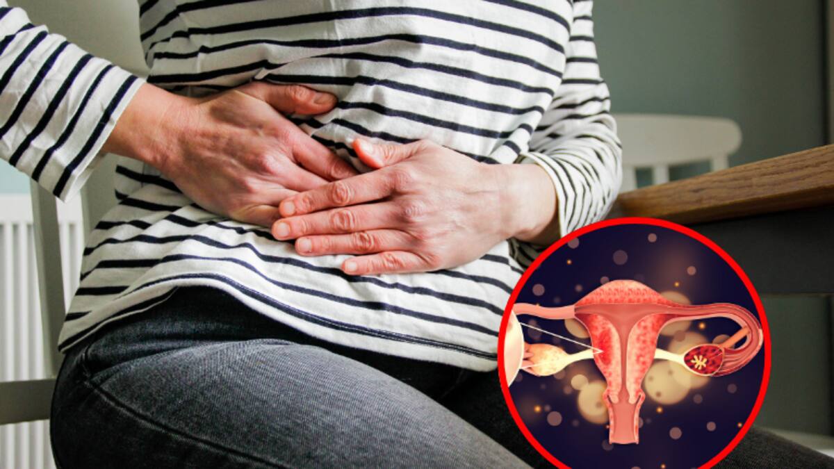 10 síntomas del cáncer de ovario: ¿en qué afecta la menopausia?