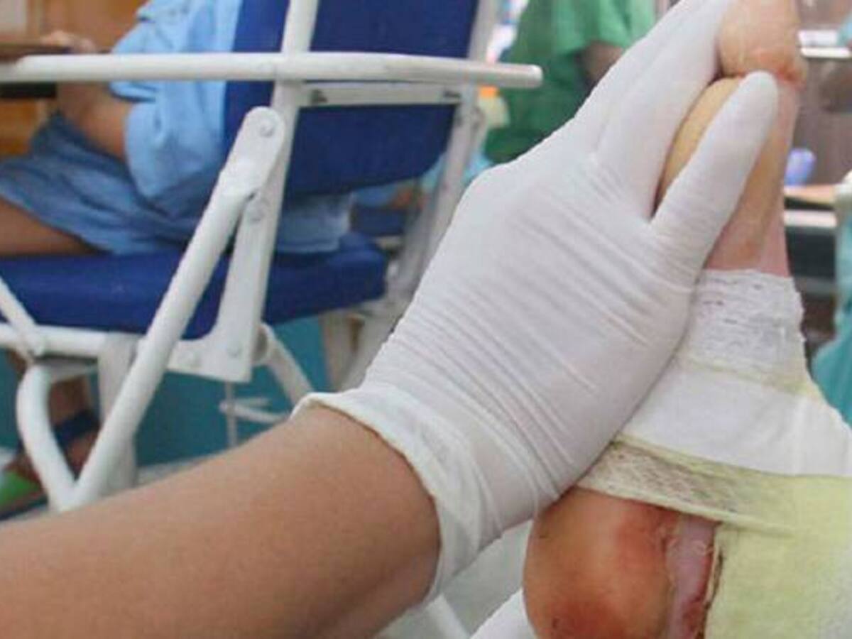 Un nuevo quemado con pólvora en Risaralda