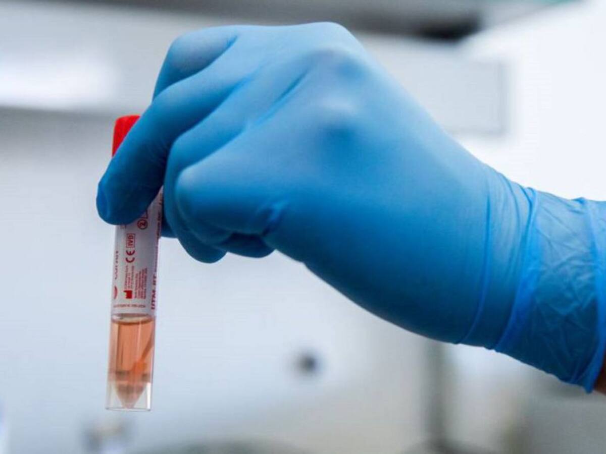 Disminución de casos COVID en Armenia depende de toma de pruebas