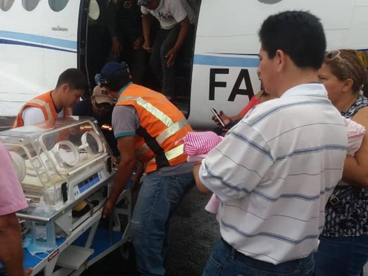 Niña nace con el corazón fuera del tórax en Bolivia