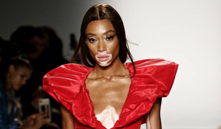 Winnie Harlow