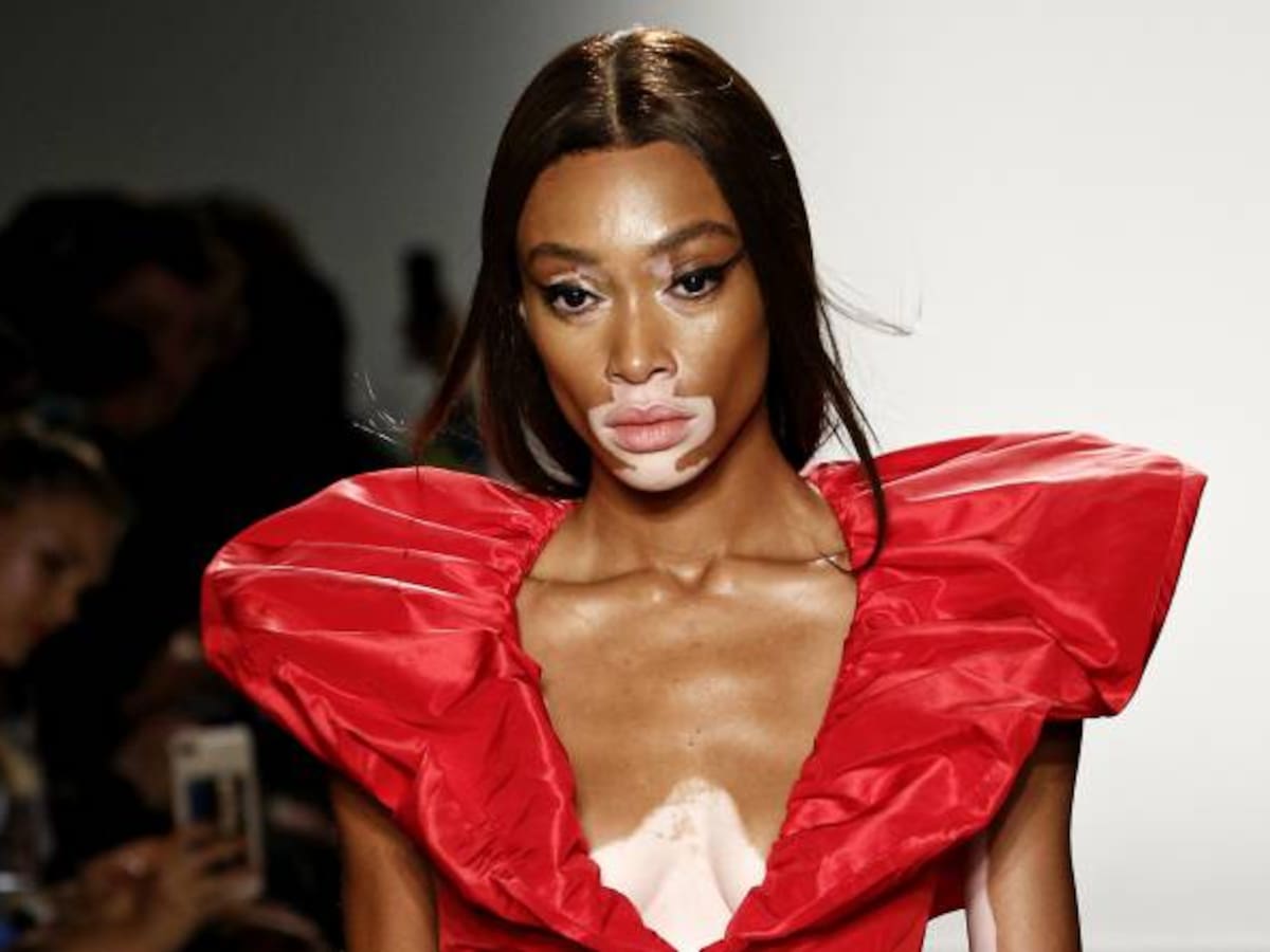 Winnie Harlow, la modelo que con vitiligo será ángel de Victoria’s Secret