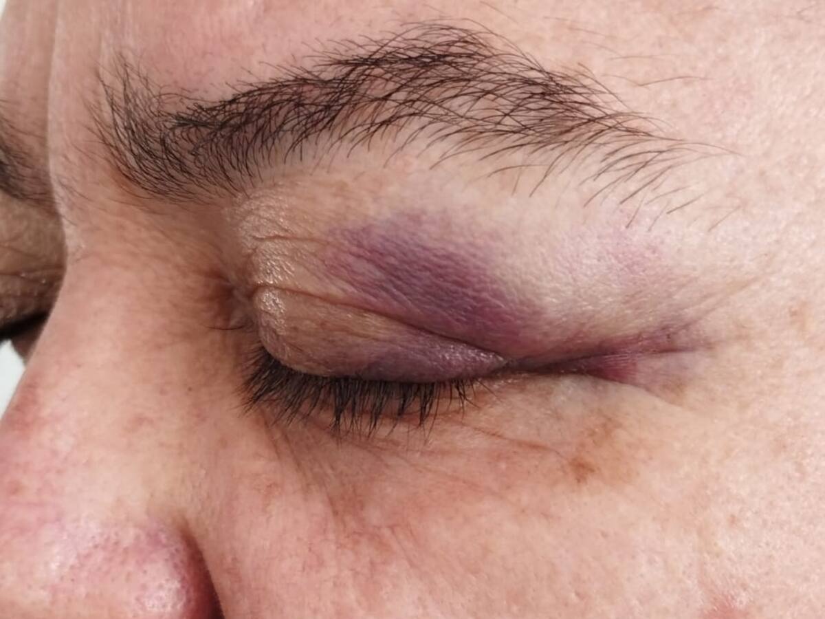 Profesora denuncia que fue golpeada por alcalde de San José de Miranda