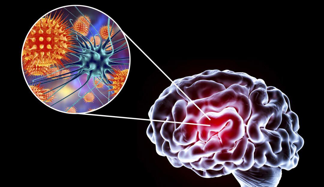 ¿Cuáles son los cambios que genera la COVID-19 en el cerebro?