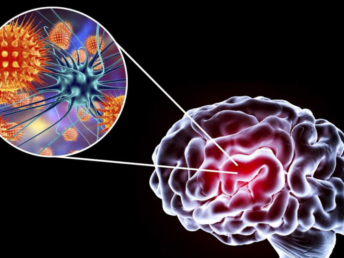 ¿Cuáles son los cambios que genera la COVID-19 en el cerebro?