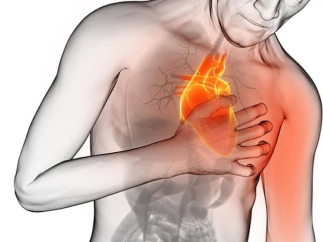 Paro cardíaco: la señal de alerta que da el estómago y que no debes ignorar