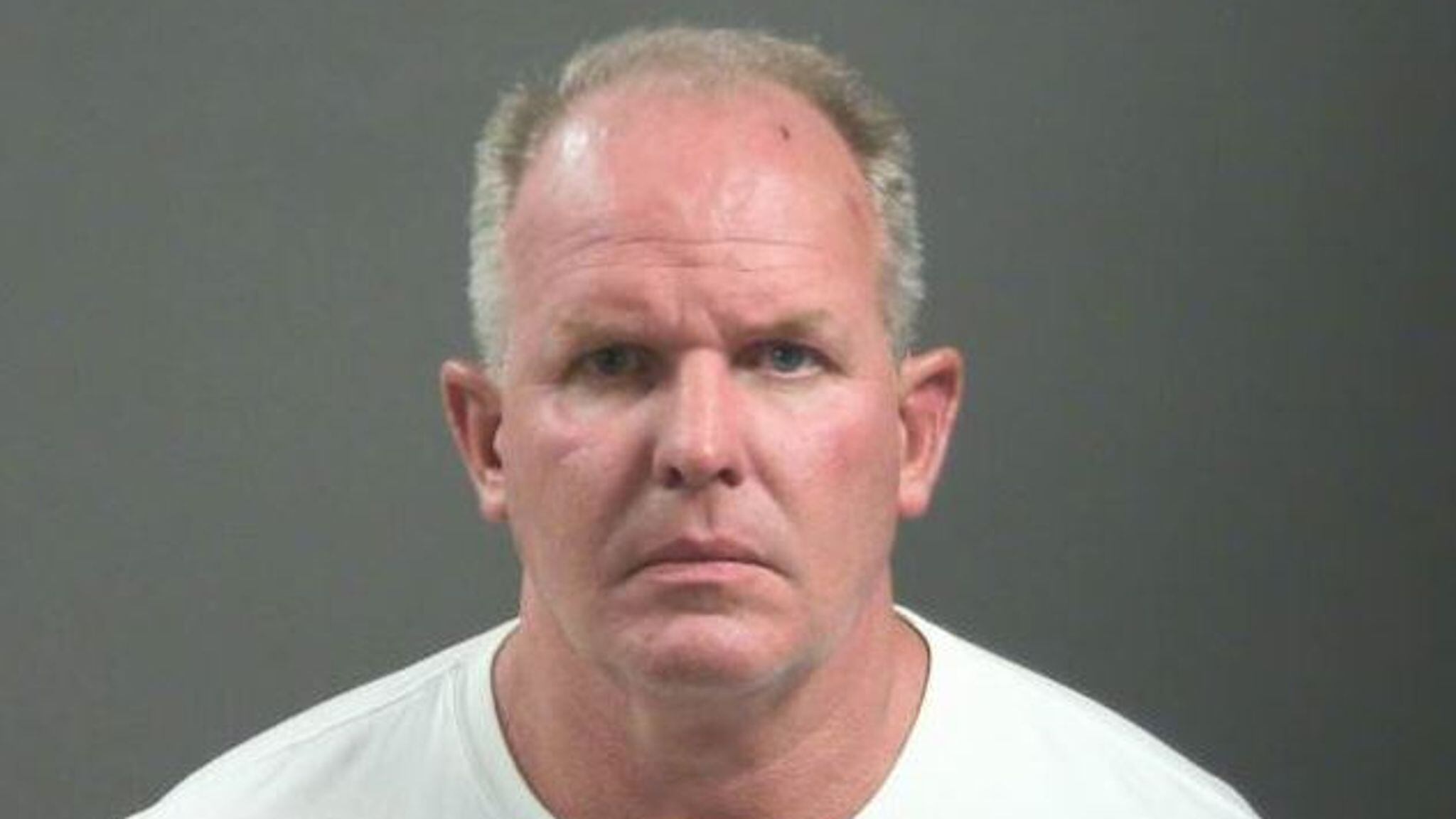 Empresario vegano habría mordido la nariz a un transeúnte en medio de una pelea