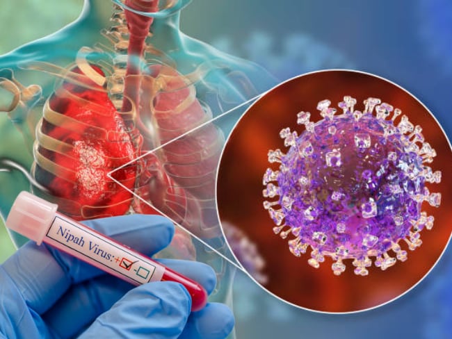 Alerta en India por el virus Nipah: ¿Podría llegar a Colombia? Síntomas y recomendaciones