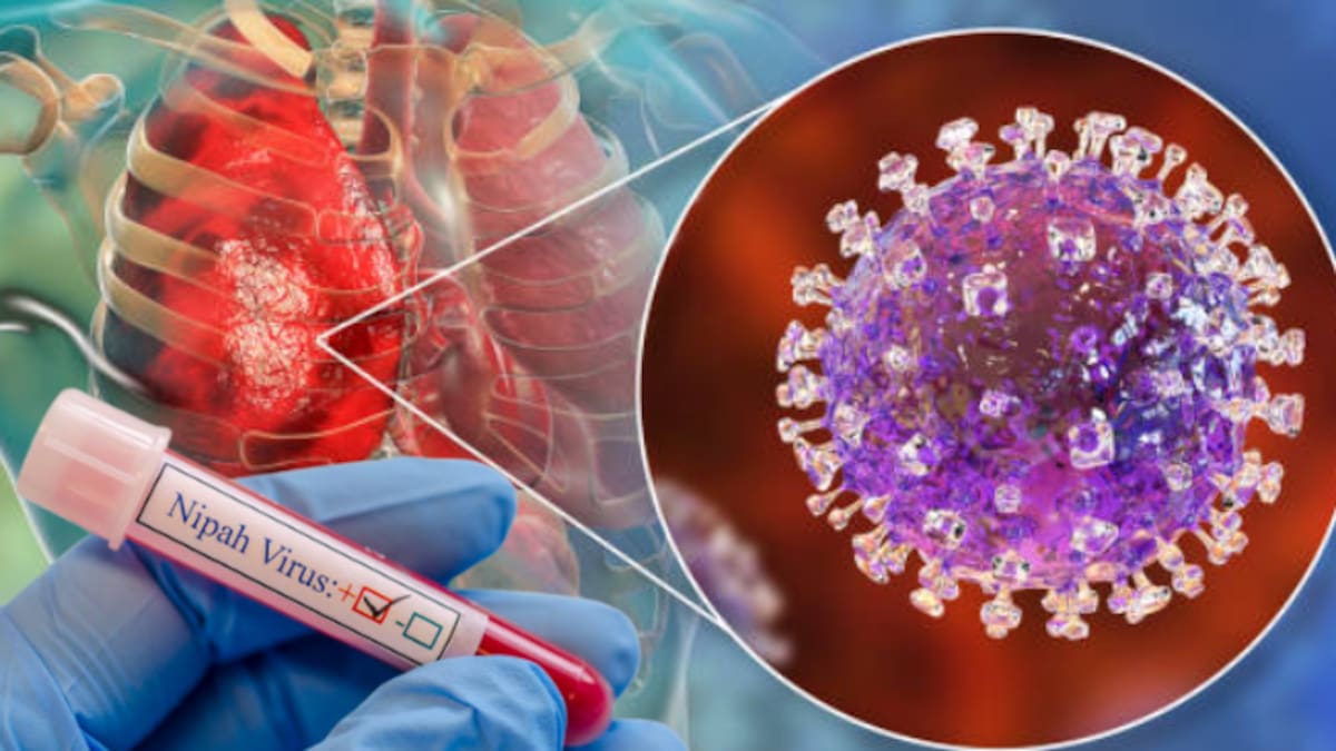 Alarma mundial por el virus Nipah: expertos descartan riesgo inmediato para Colombia