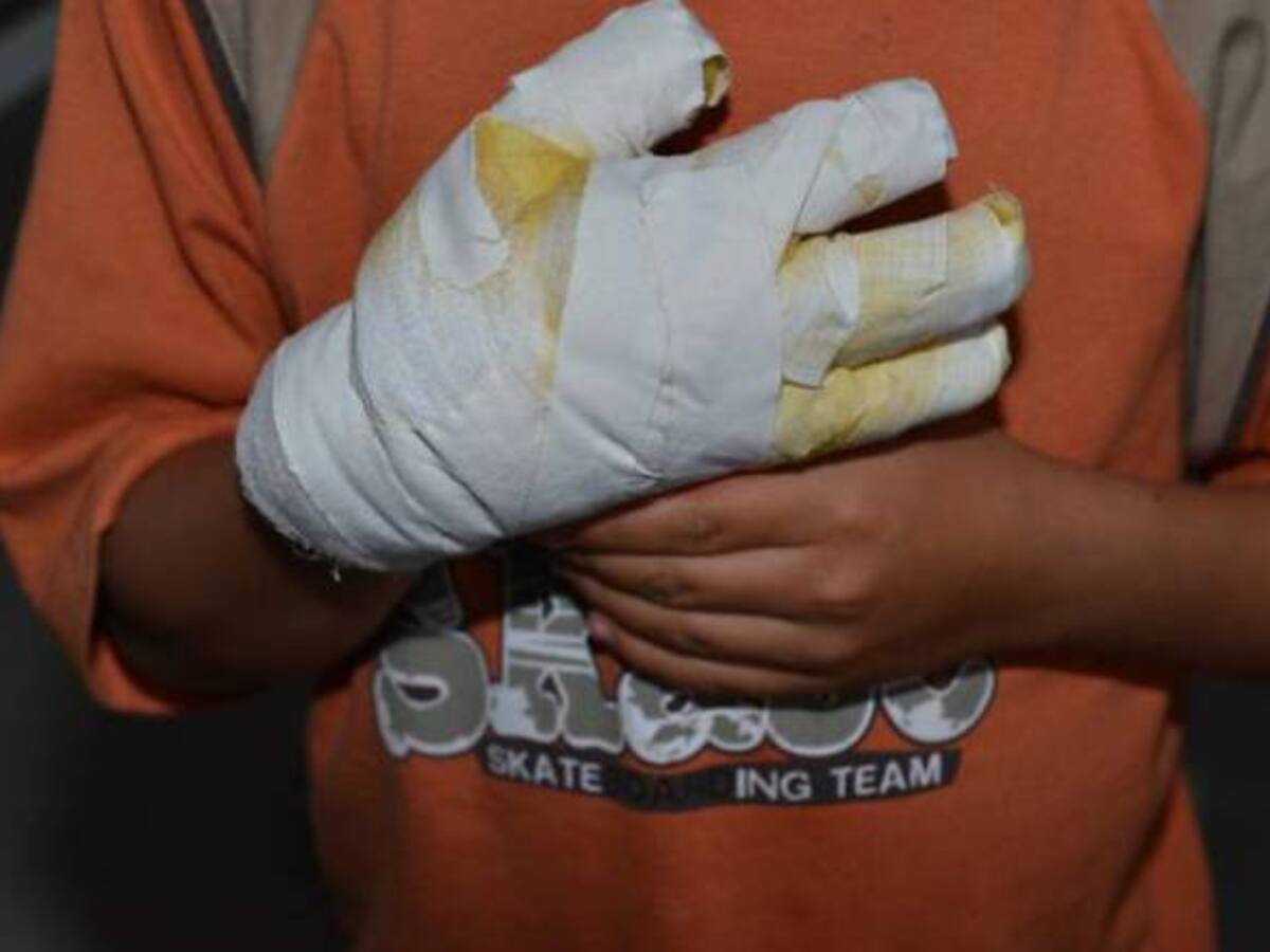 Seis quemados con pólvora en lo corrido de diciembre en Risaralda