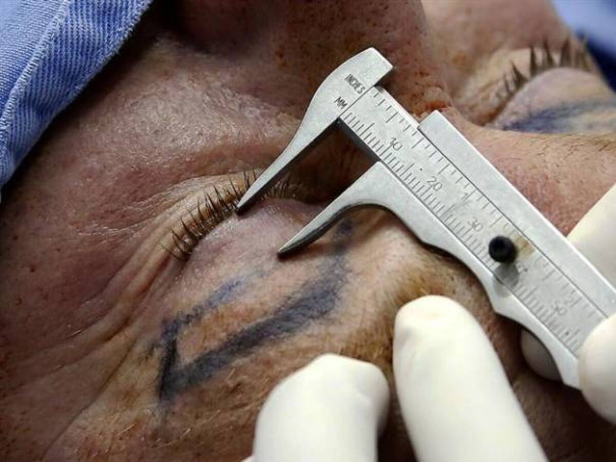 Precluye investigación a periodista que denunció a medico por malos procedimientos estéticos