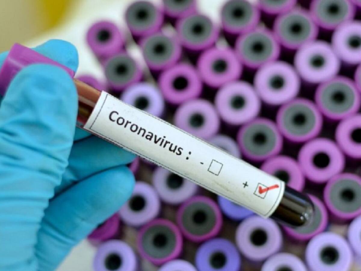 129 casos de Coronavirus reporta Norte de Santander