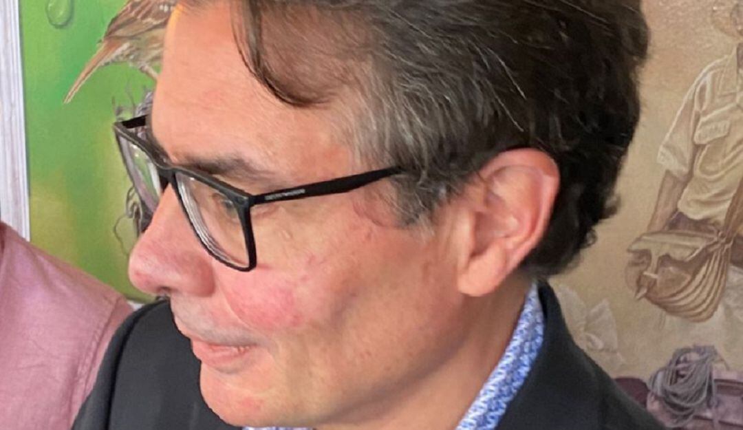 Foto: Precandidato presidencial y exministro de Salud, Alejandro Gaviria. 