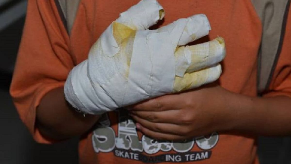 Muere menor luego de explosión de una polvorería en Roldanillo, Valle