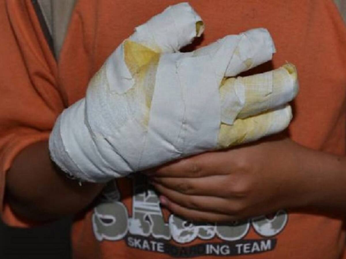 Muere menor luego de explosión de una polvorería en Roldanillo, Valle