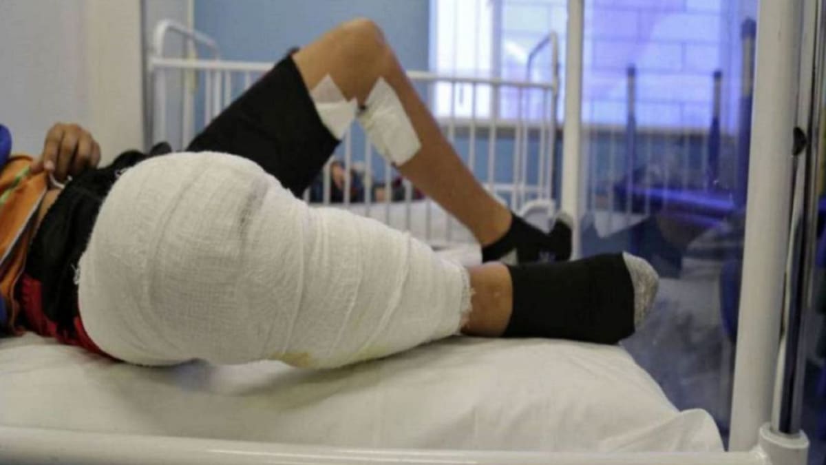 Niño de nueve años es el primer quemado con pólvora en Cali del año