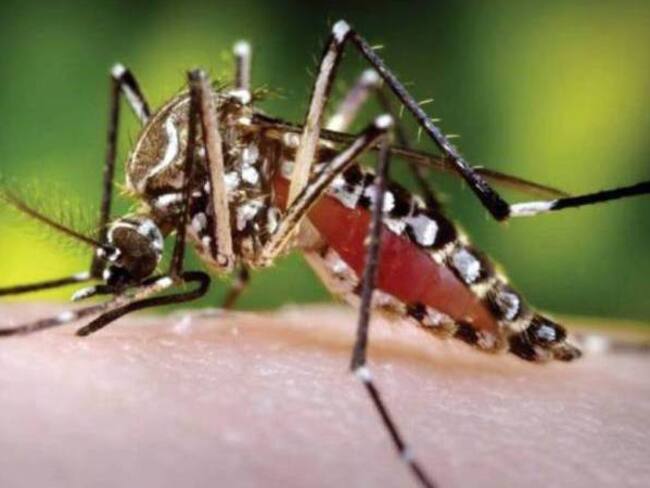 Médico Bayron Martínez, explica la microcefalia