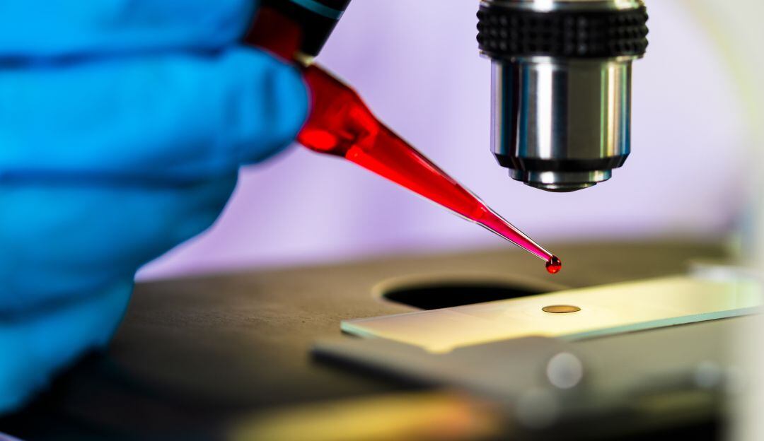 Imagen de referencia laboratorio prueba VIH