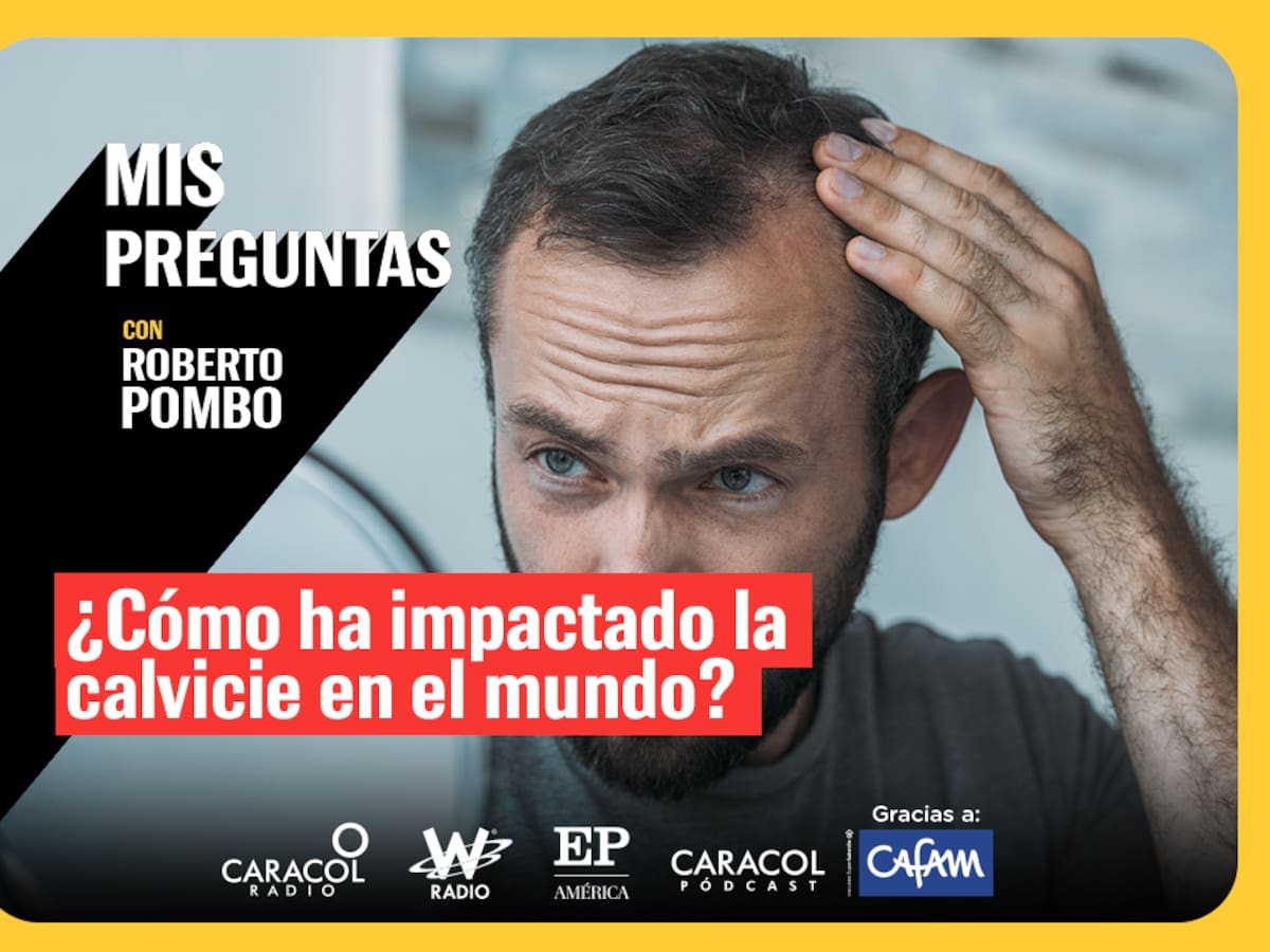 Mis Preguntas con Roberto Pombo: ¿Qué tanto ha impactado la calvicie en el mundo?