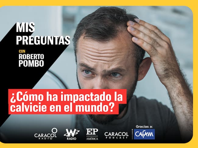 ¿Qué tanto ha impactado la calvicie en el mundo?
