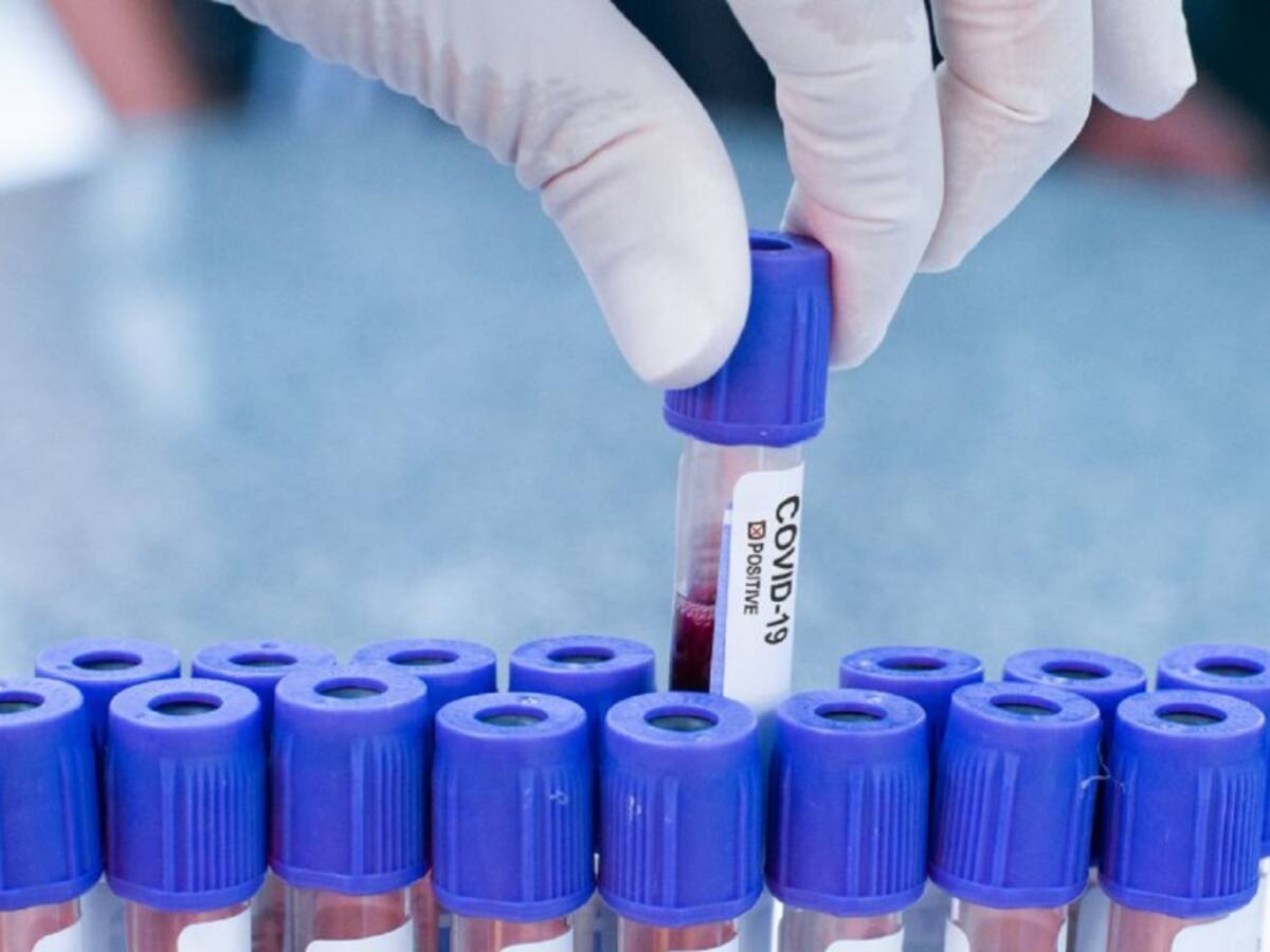 Autoridades piden castigo para quienes están alterando resultados COVID-19