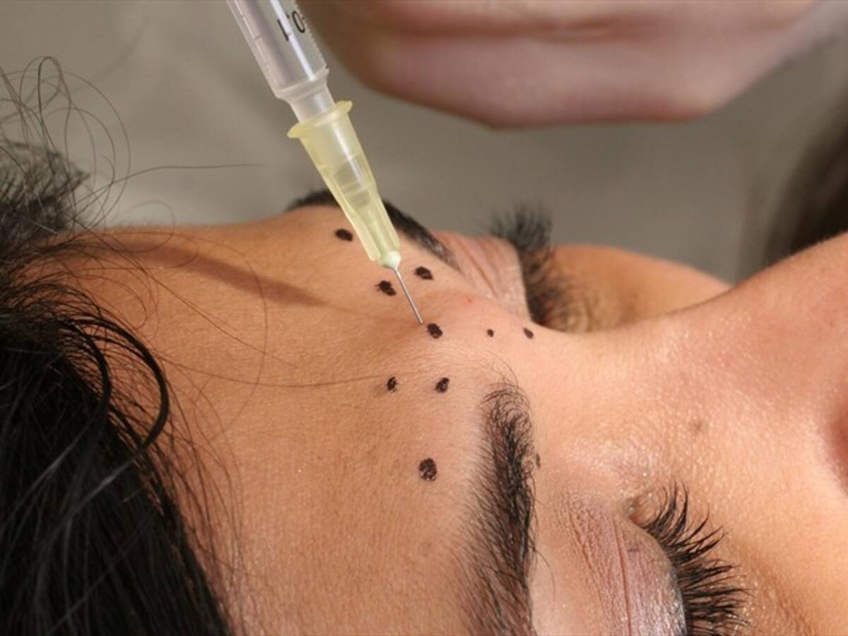 Inyecciones de rejuvenecimiento facial dejan ciegas a tres personas en Cali
