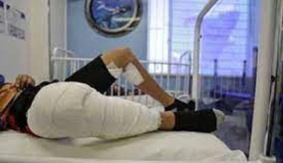 Sigue aumentando el número de quemados con pólvora en el Tolima